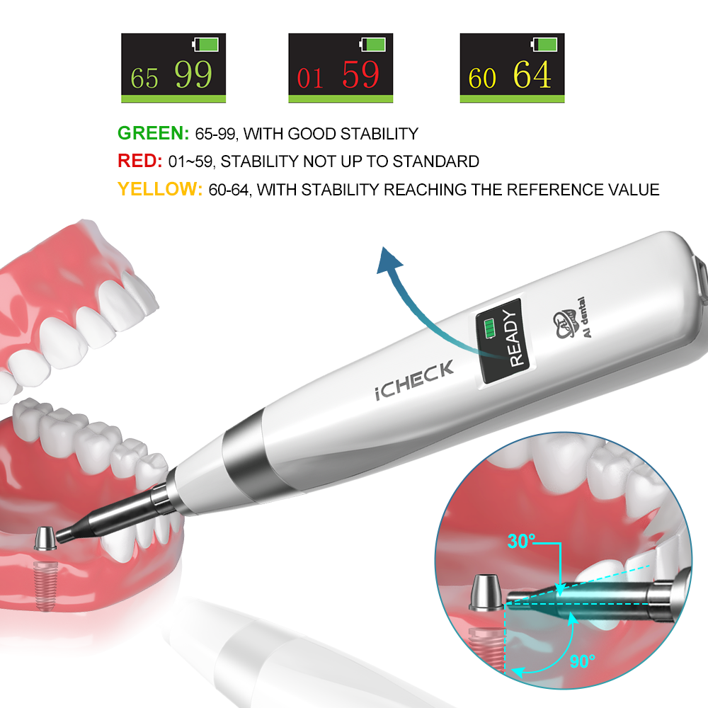 AI Dental Implant Stability Me - đánh giá và giá Stabilizer Screw In