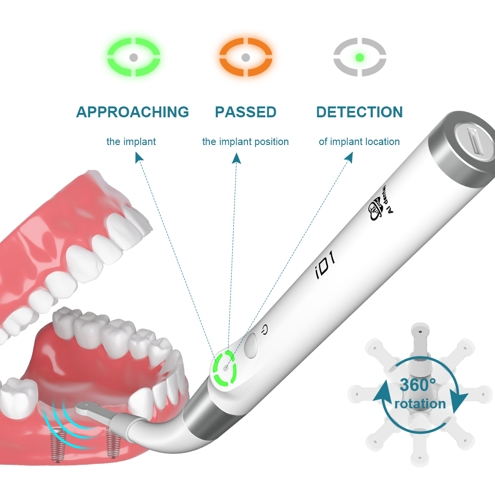 AI Dental Implant Stability Me - đánh giá và giá Stabilizer Screw In